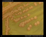 proteus on deoxycholate citrate agar